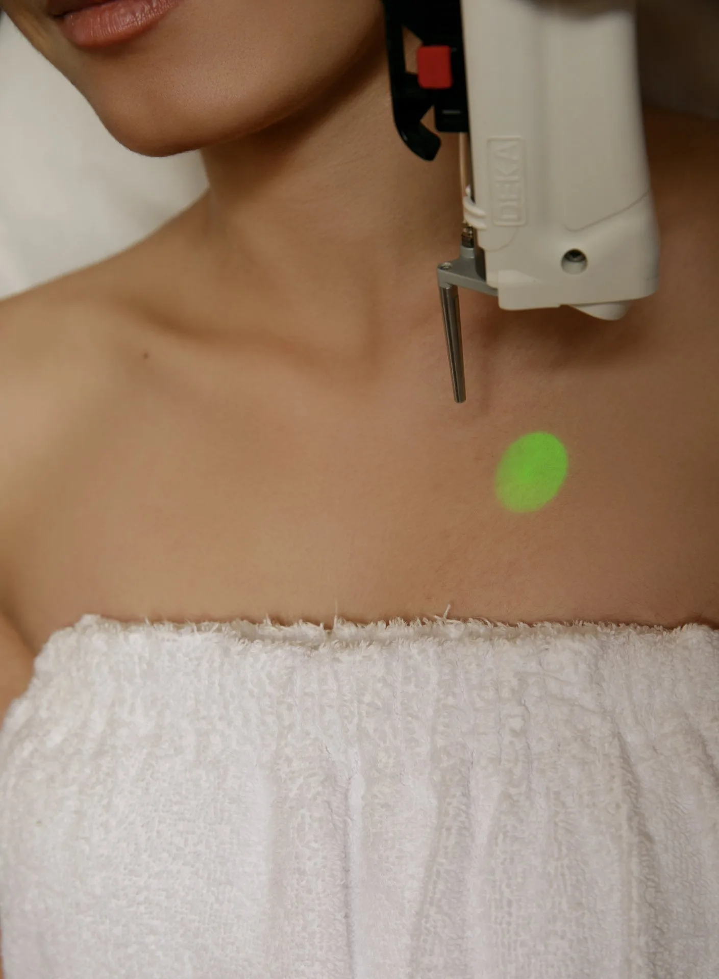 LASER DEKA MOTUS AX | CHEST