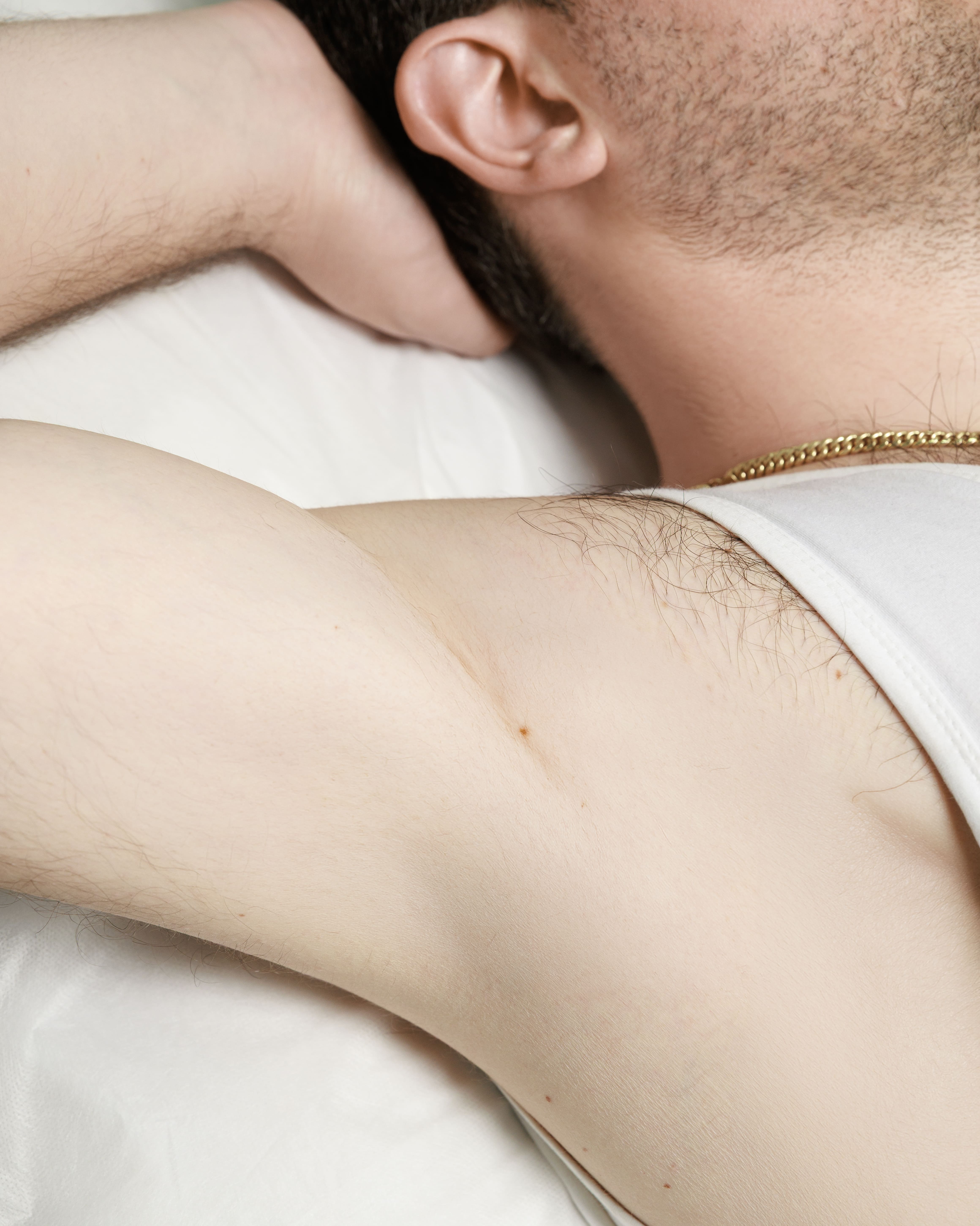 BOTULINUM TOXIN |  HYPERHIDROSIS TREATMENT 1 AREA