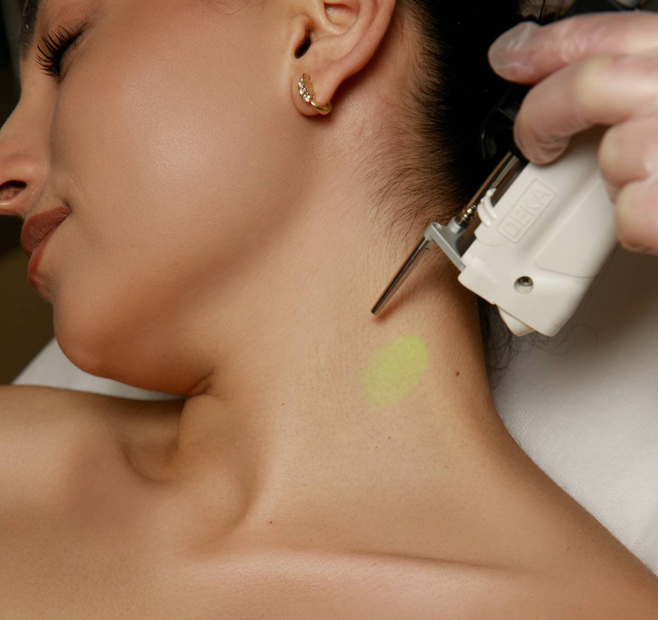 LASER DEKA MOTUS AX | NECK FRONT