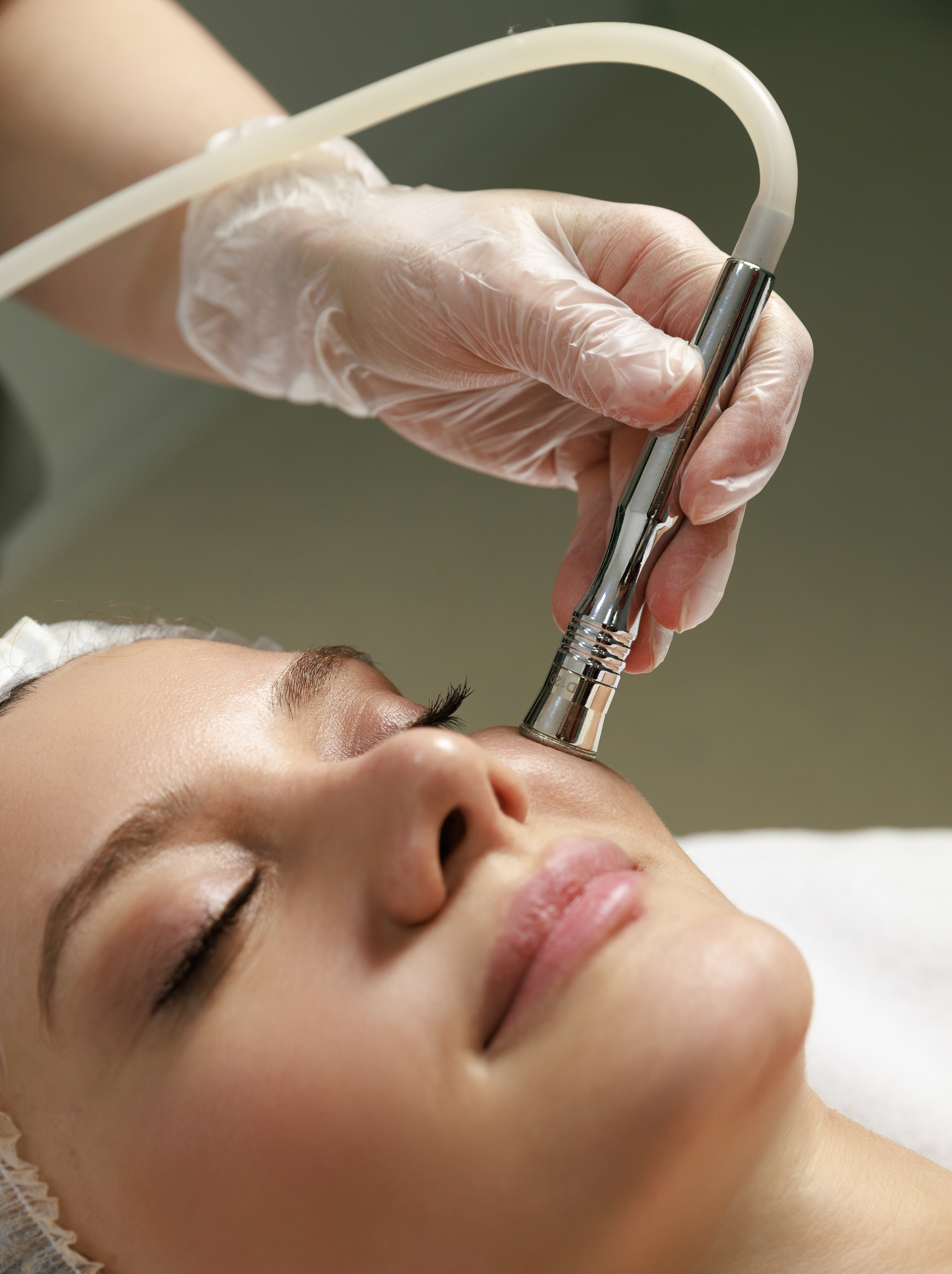 MICRODERMABRASION