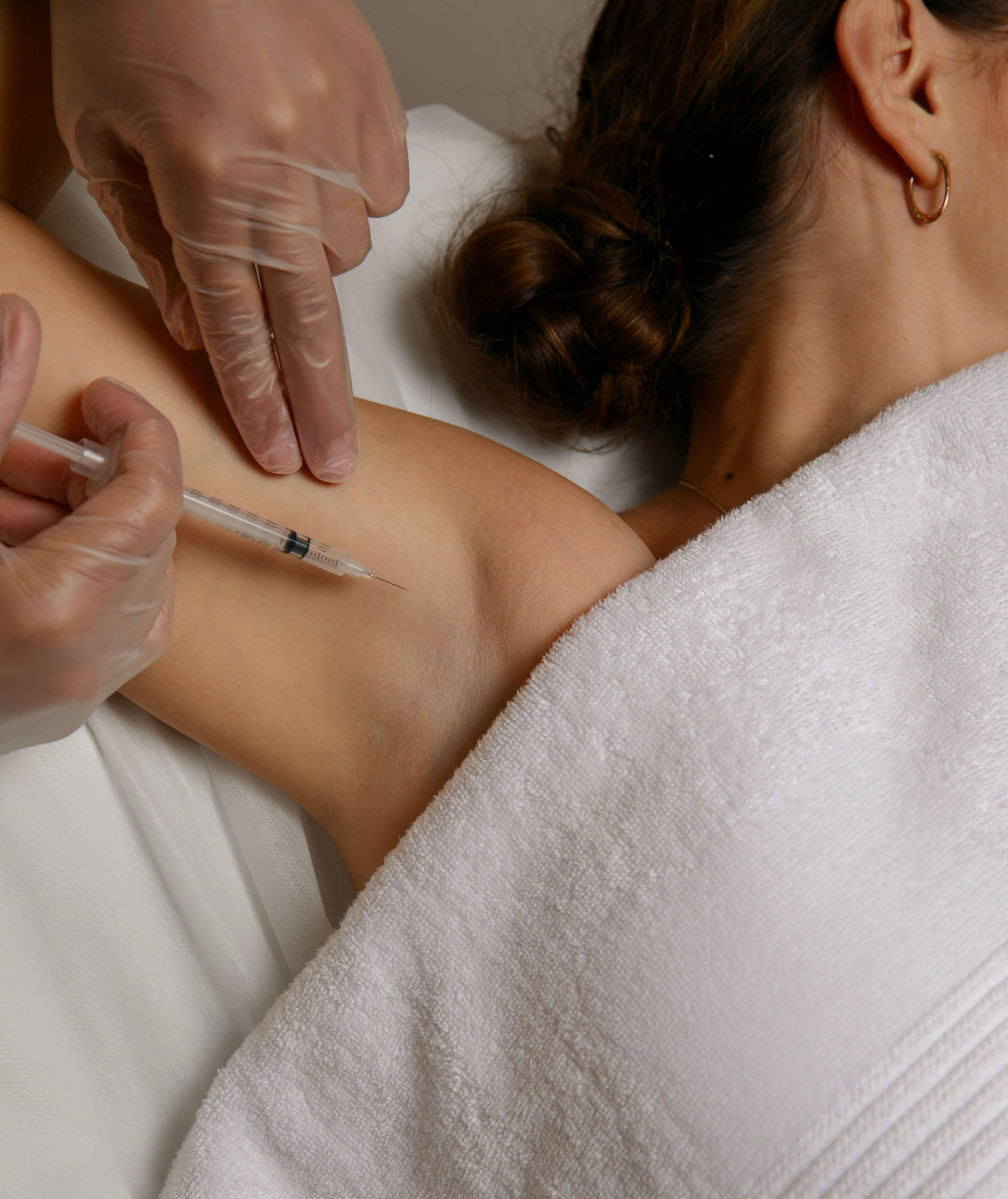 BOTULINUM TOXIN |  HYPERHIDROSIS TREATMENT 1 AREA