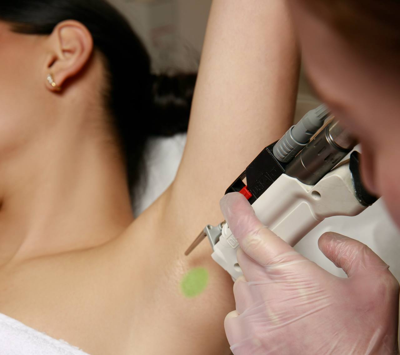 LASER DEKA MOTUS AX | ARMPITS