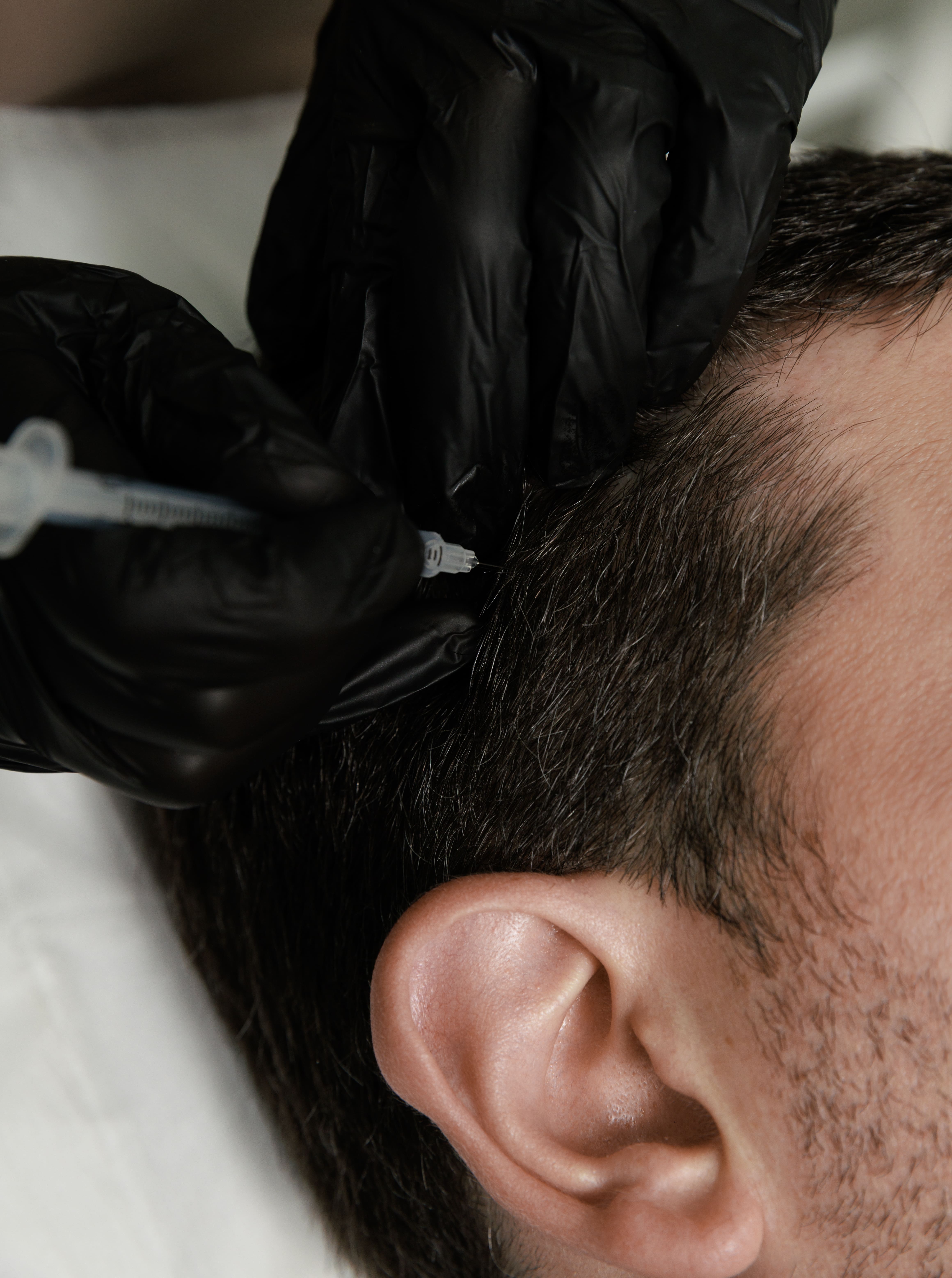 BOTULINUM TOXIN | MIGREN TREATMENT